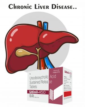 Ursodeoxycholic Acid Sustanied Release Tablets IP-450